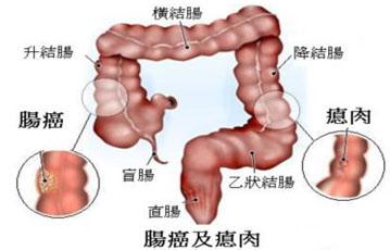 大肠